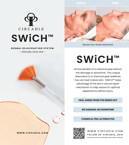 Brochures, SWiCH - 50 pack